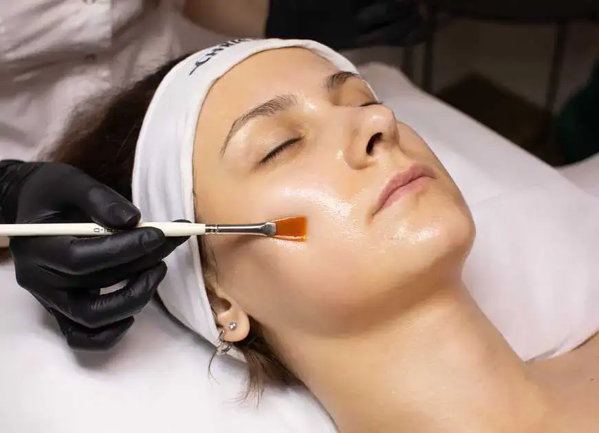 Chemical Peel Treatment by Cultivated Beauty Aesthetic in Guntersville AL