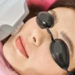 Women receiving IPL in Guntersville AL