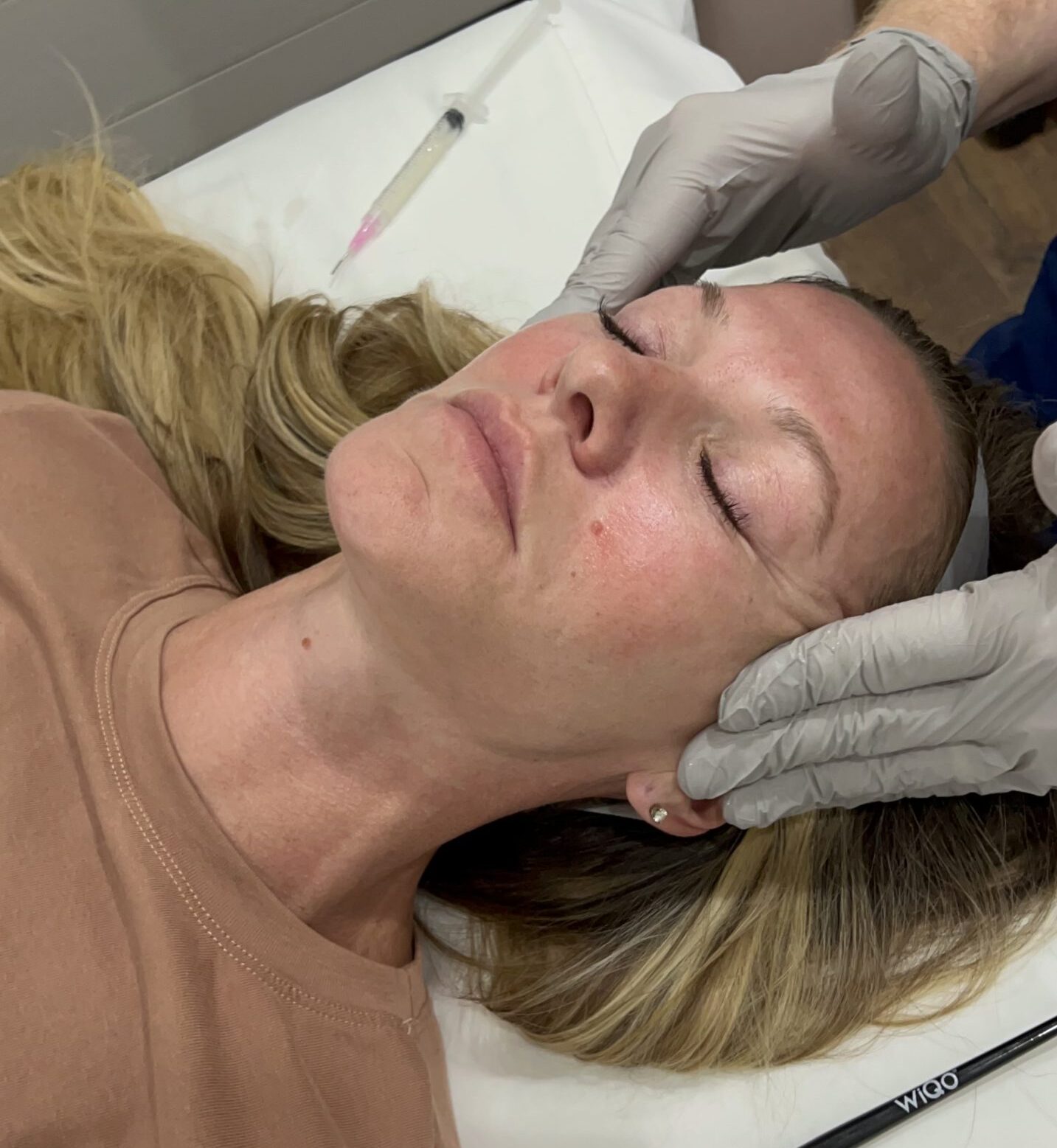 Chemical peels treatment at Cultivated Beauty Aesthetic in Guntersville, AL