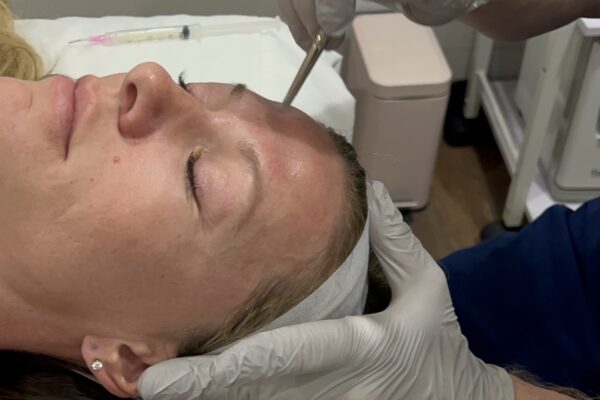 PRX T33 Biorevitalization Peel 3