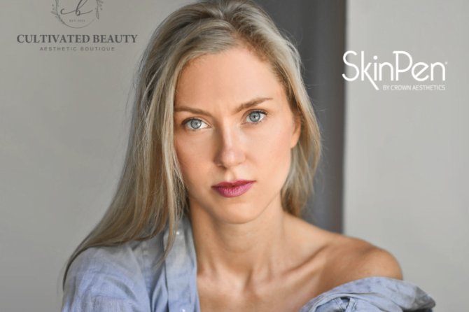 Beautiful lady with pretty face | Skinpen Microneedling at Cultivated Beauty Aesthetic in Guntersville, AL