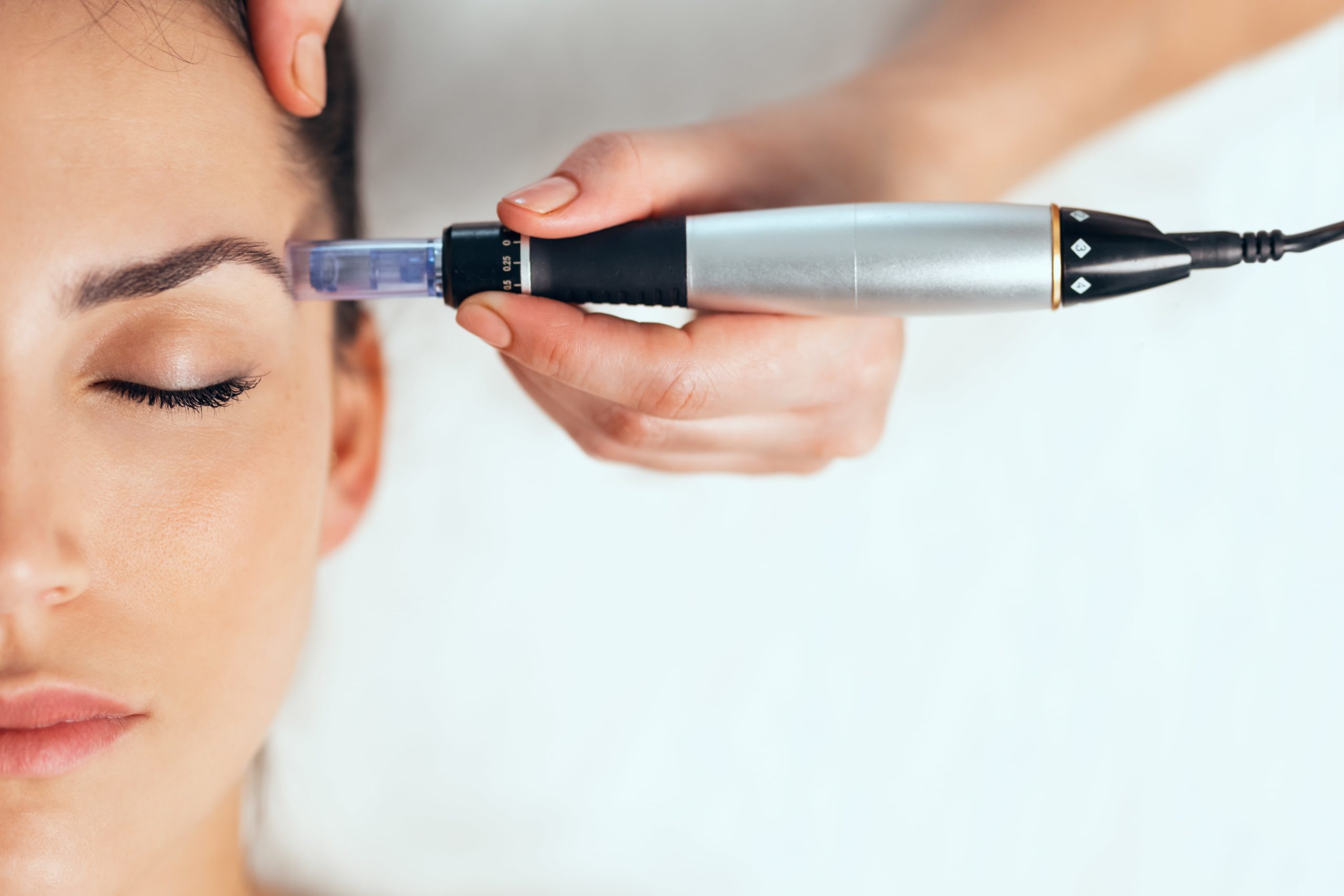 A Lady taking Microneedling | Cultivated Beauty Aesthetic in Guntersville, AL