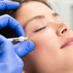 Women receiving PRP Therapy in Guntersville, AL